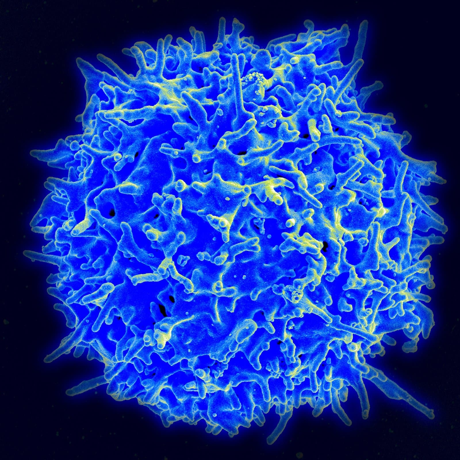 Scanning electron micrograph of a single human T lymphocyte, or T cell, from the immune system of a healthy donor, its surface covered in small projections. Illustrative image of a T cell, not from the invika trial. Image: NIAID/NIH, public domain, via Wikimedia Commons. Source page: https://commons.wikimedia.org/wiki/File:Healthy_Human_T_Cell.jpg