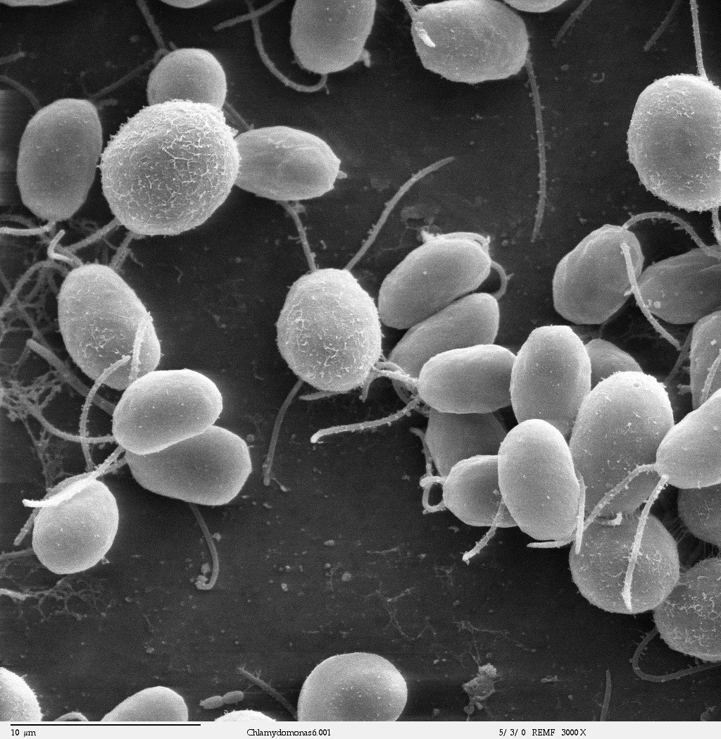 A black-and-white scanning electron micrograph of many small, rounded single-celled algae, several trailing thin flagella, scattered across a surface.