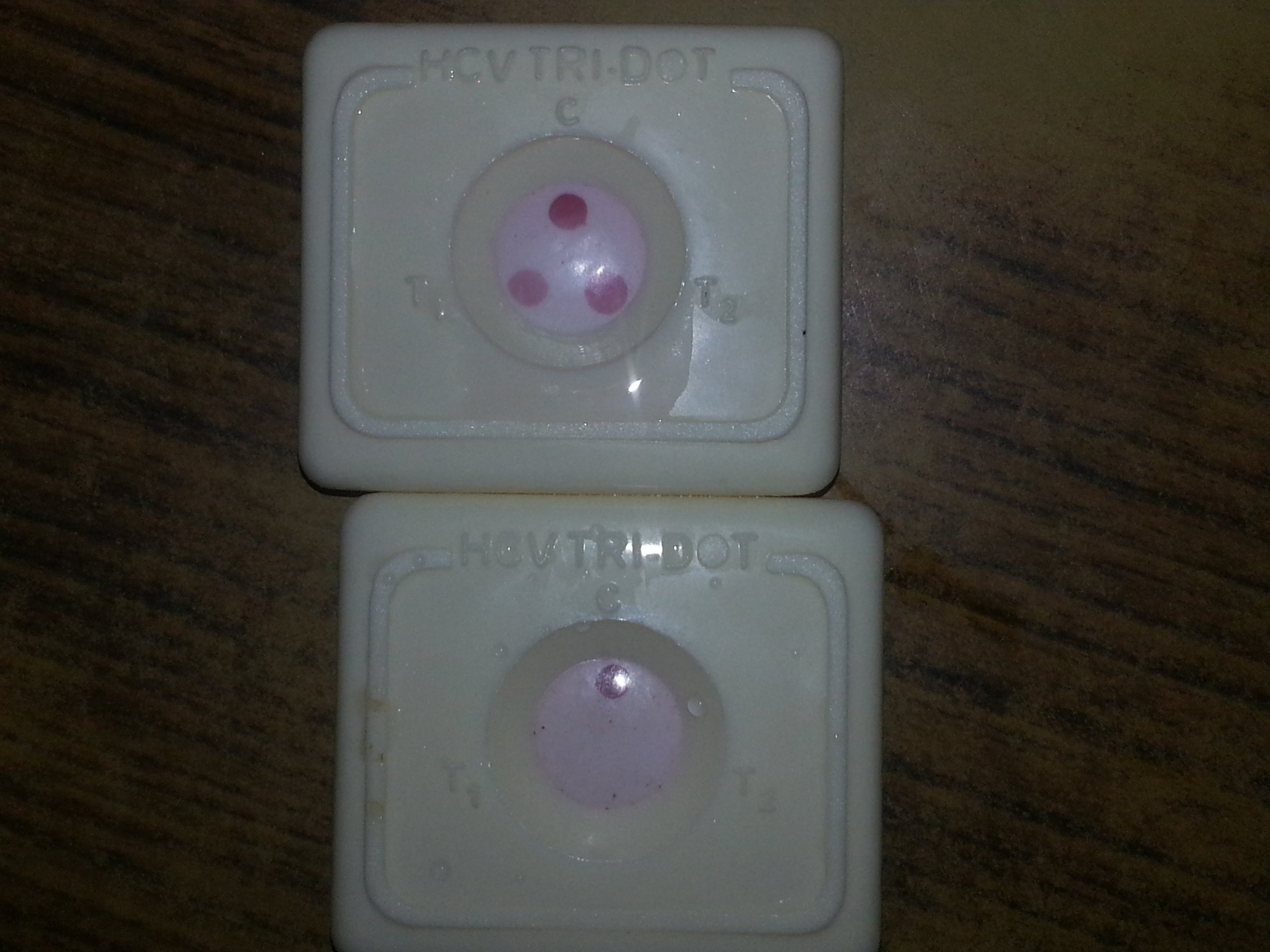 Two rapid hepatitis C antibody test devices side by side, one showing a positive result and one negative.