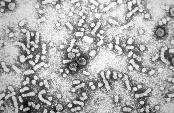 Transmission electron micrograph of hepatitis B virus particles.