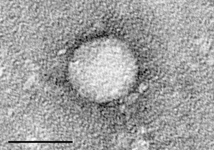 Grayscale electron micrographs of small round hepatitis C virus particles.