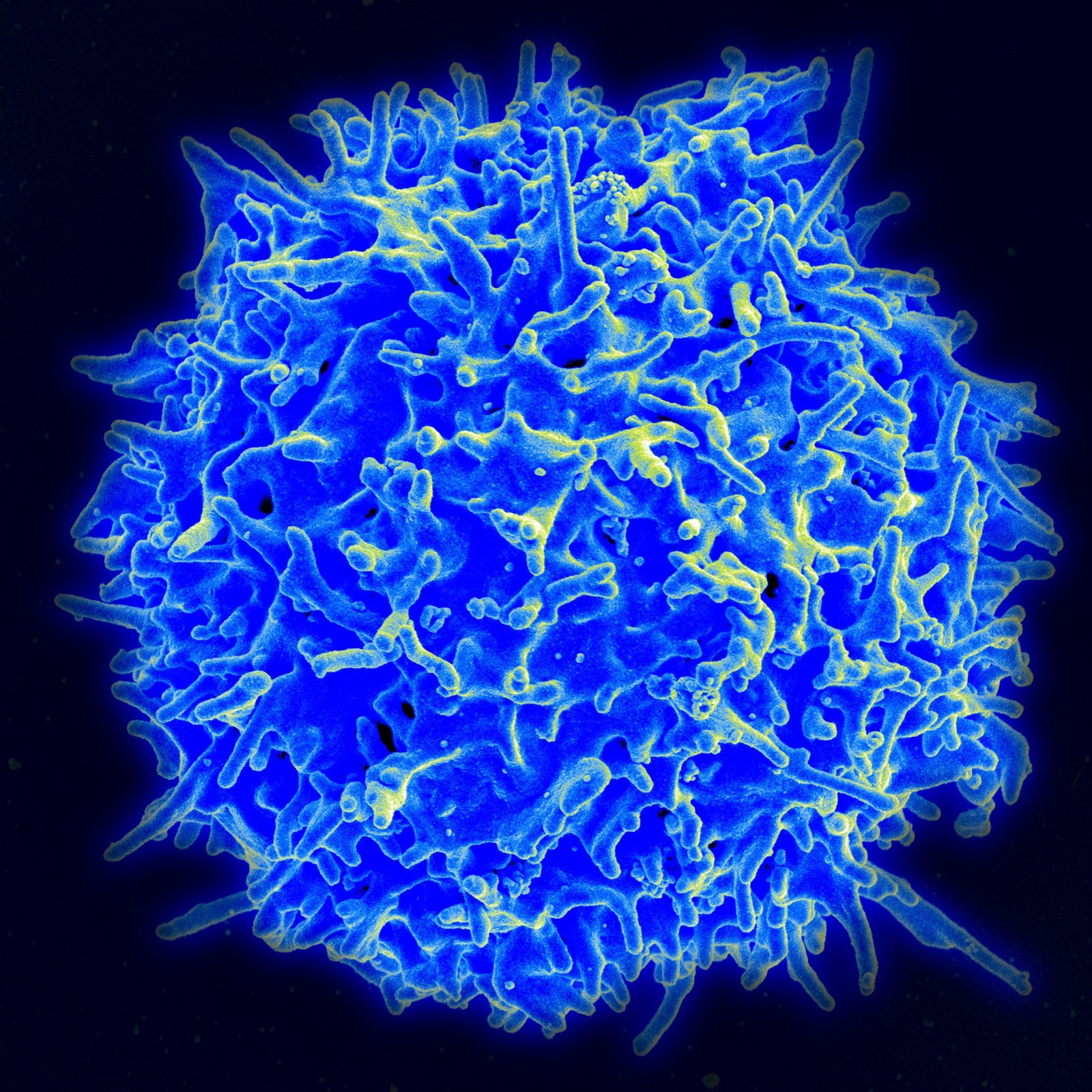 Scanning electron micrograph of a single round human T cell covered in small surface projections, against a dark background.